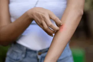Sintomi dengue