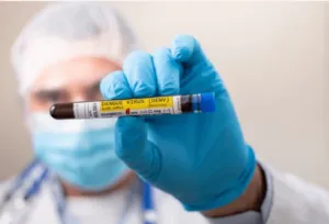 Infezione virus dengue